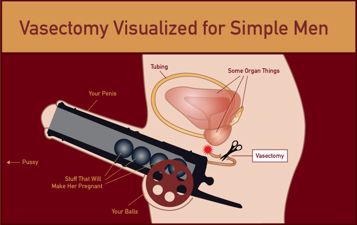 Image result for Vasectomy visualized for simple men